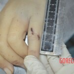 Chinese woman in morgue