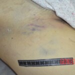 Chinese woman in morgue