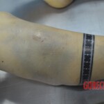 Chinese woman in morgue