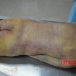 Chinese woman in morgue