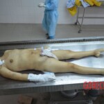 Chinese woman in morgue