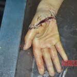 Chinese woman in morgue