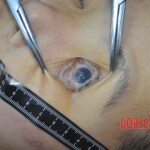 Chinese woman in morgue