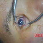 Chinese woman in morgue