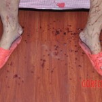 Raped and stabbed female