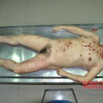 Raped and stabbed female