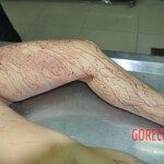 Raped and stabbed female