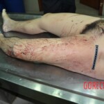 Raped and stabbed female