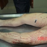 Raped and stabbed female