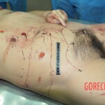 Raped and stabbed female