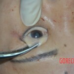 Raped and stabbed female