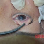 Raped and stabbed female