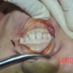 Raped and stabbed female