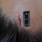 Raped and stabbed female