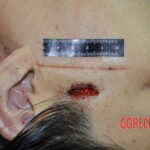 Raped and stabbed female