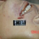 Raped and stabbed female