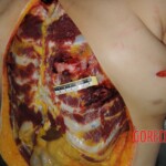 Stabbed chinese woman