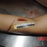 Stabbed chinese woman
