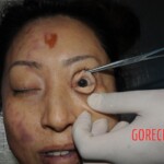 Stabbed chinese woman