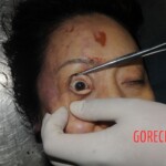 Stabbed chinese woman