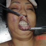 Stabbed chinese woman