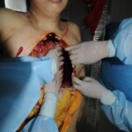 Stabbed chinese woman