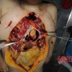 Stabbed chinese woman