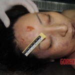 Stabbed chinese woman