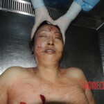 Stabbed chinese woman