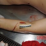 Stabbed chinese woman
