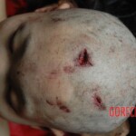 Raped and murdered girl