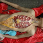 Raped and murdered girl