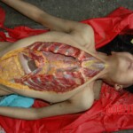 Raped and murdered girl