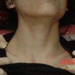 Raped and murdered girl