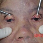 Autopsy of pregnant woman