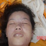 Autopsy of pregnant woman