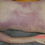 Autopsy of pregnant woman