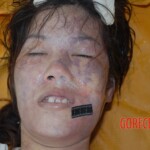 Autopsy of pregnant woman