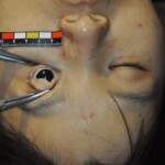 Murdered Chinese girl