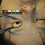 Murdered Chinese girl