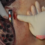 Murdered Chinese girl