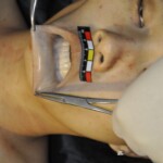 Murdered Chinese girl