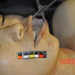 Murdered Chinese girl