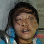 Dead chinese woman