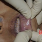 Examination of dead Chinese woman