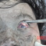 Drowned Chinese girl