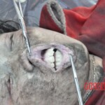 Drowned Chinese girl