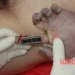 Examination of Chinese woman