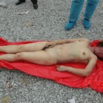 Examination of Chinese woman