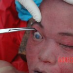 Examination of Chinese woman